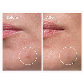 Concentré Crème-en-Poudre de Soufre 10% - Soin anti-imperfections