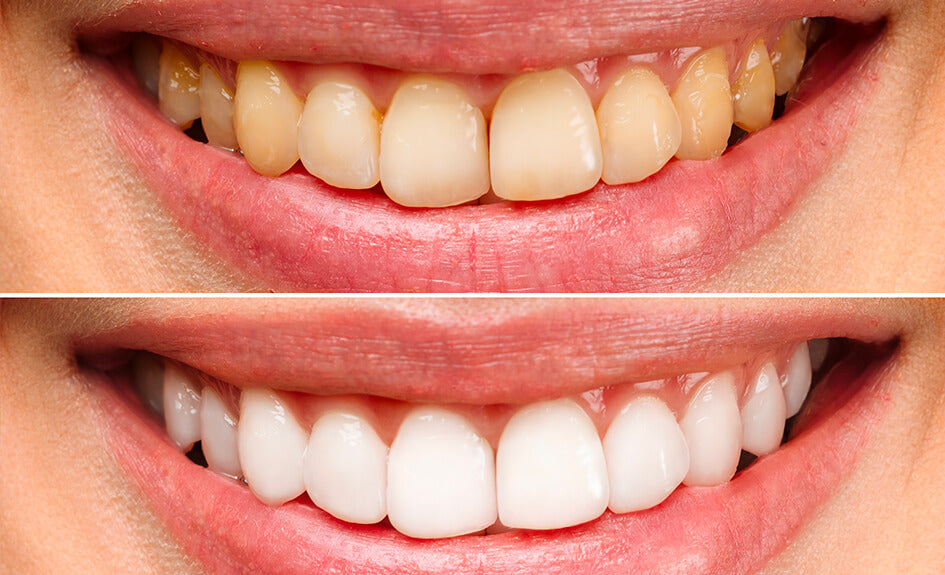 Dentifrice Menthe Blanchissant Smoker