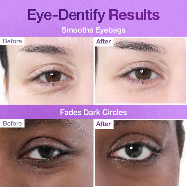 Patchs pour les yeux au collagène NAD+ n° 9 - 1 unités